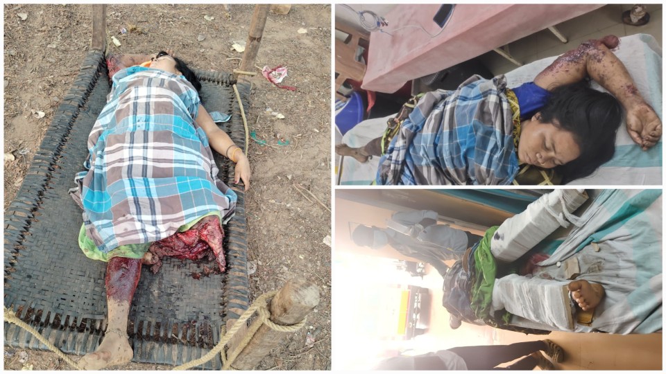 बीजापुर: माओवादियों के IED ब्लास्ट में महिला गंभीर रूप से घायल, दो साल में तीसरी बड़ी घटना… बीजापुर: माओवादियों के IED ब्लास्ट में महिला गंभीर रूप से घायल, दो साल में तीसरी बड़ी घटना…