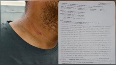 सारंगढ़ में पत्रकार पर जानलेवा हमला: गर्दन पर किया वार, बाल-बाल बचा युवा पत्रकार…