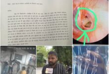 CG-13 ढाबा कांड : 20 दिन बाद भी आरोपी खुलेआम घूम रहे, पुलिस मूकदर्शक – एक का टूटा पैर, दूसरे का फटा कान, फिर भी कानून खामोश!…