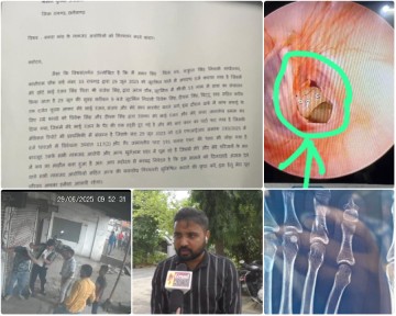 CG-13 ढाबा कांड : 20 दिन बाद भी आरोपी खुलेआम घूम रहे, पुलिस मूकदर्शक – एक का टूटा पैर, दूसरे का फटा कान, फिर भी कानून खामोश!…