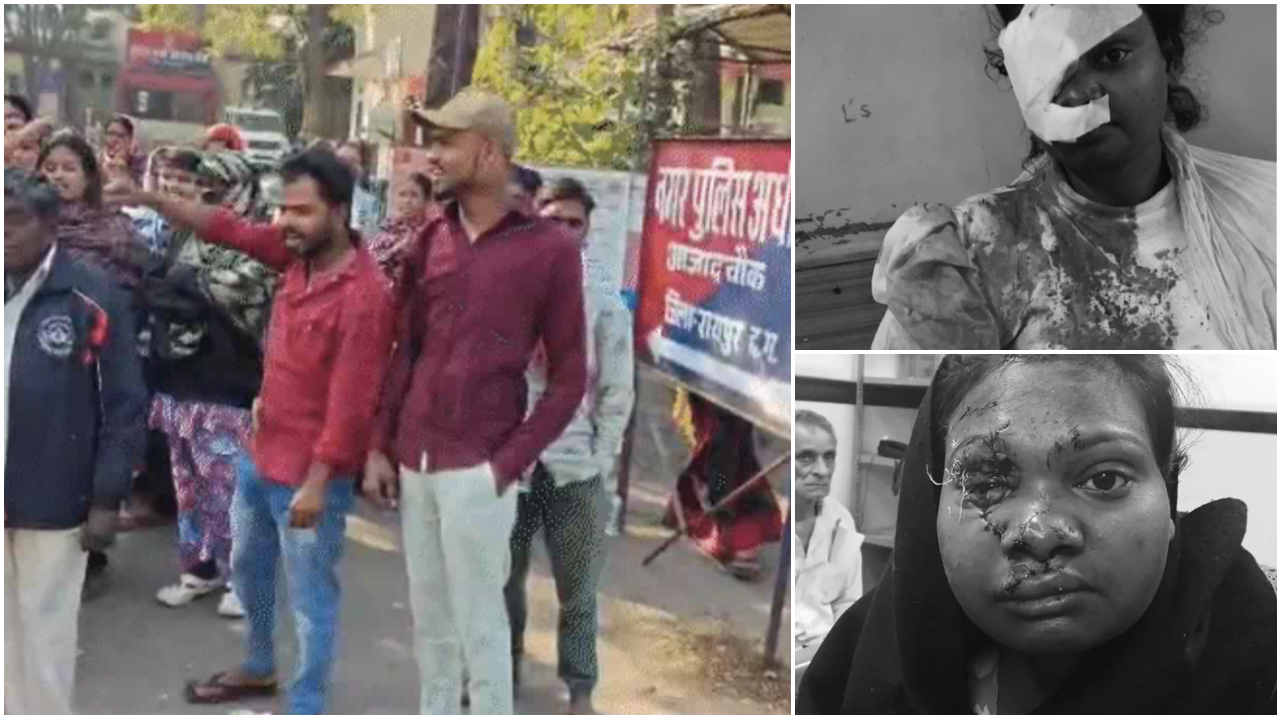 रायपुर में खूनी ‘डेट’ : बीयर बार में बॉयफ्रेंड ने फोड़ी बोतल, 23 दिन बाद मौत की जंग हारी वेदिका…