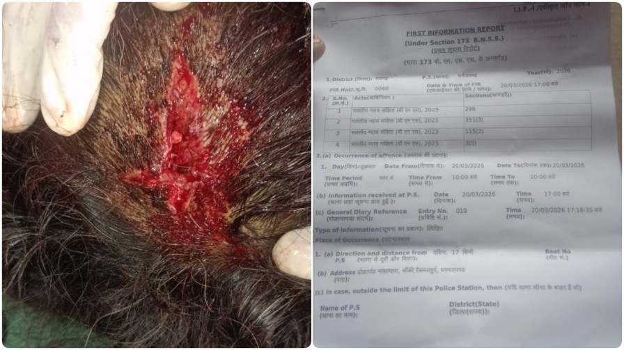 खूनी संघर्ष : महुआ बीनने गई मां-बेटी पर कुल्हाड़ी के पासा से जानलेवा हमला, रायगढ़ के धरमजयगढ़ में जमीन विवाद ने पकड़ी आग…