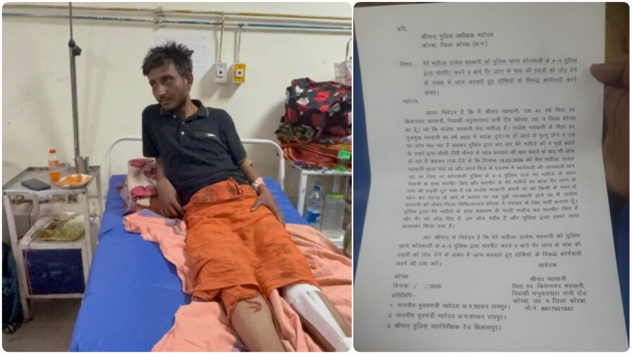 खाकी के ‘खौफ’ में न्याय का कत्ल: कोरबा पुलिस ने मदद मांगने आए युवक की हड्डी तोड़ी, वर्दी हुई शर्मसार!…