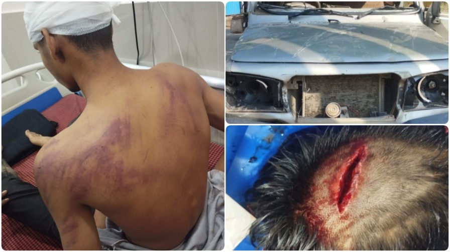 बिलासपुर : खुशियों की गूंज के बीच खूनी संघर्ष; तखतपुर के कुंआ गांव में बारात बनी ‘रणक्षेत्र’…