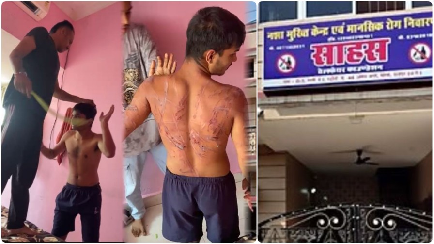 रायपुर का ‘साहस’ नशा मुक्ति केंद्र बना ‘क्रूरता का अड्डा’ : नशे की लत क्या छुड़ाते, युवक को मार-मार कर बना दिया विक्षिप्त ; FIR दर्ज…