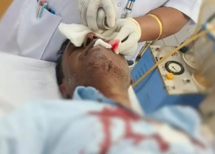 सूरजपुर में खूनी संघर्ष : SECL मैनेजर पर जानलेवा पथराव, सड़क निर्माण के विरोध में उग्र हुए ग्रामीण…