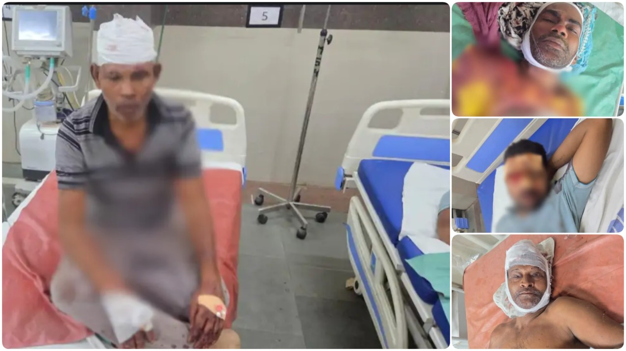 खेत बना कुरुक्षेत्र: पैतृक जमीन के लिए खून के प्यासे हुए सगे भाई, कुल्हाड़ी और रॉड से खूनी खेल, 6 लहुलुहान!… खेत बना कुरुक्षेत्र: पैतृक जमीन के लिए खून के प्यासे हुए सगे भाई, कुल्हाड़ी और रॉड से खूनी खेल, 6 लहुलुहान!…
